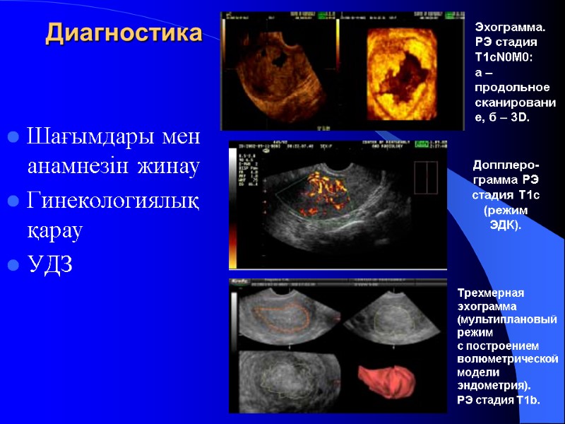 Шағымдары мен анамнезін жинау Гинекологиялық қарау УДЗ   Эхограмма. РЭ стадия T1сN0M0: 